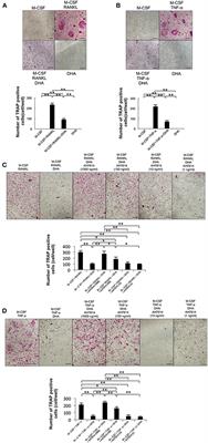 Docosahexaenoic Acid Inhibits Inflammation-Induced Osteoclast Formation and Bone Resorption in vivo Through GPR120 by Inhibiting TNF-α Production in Macrophages and Directly Inhibiting Osteoclast Formation